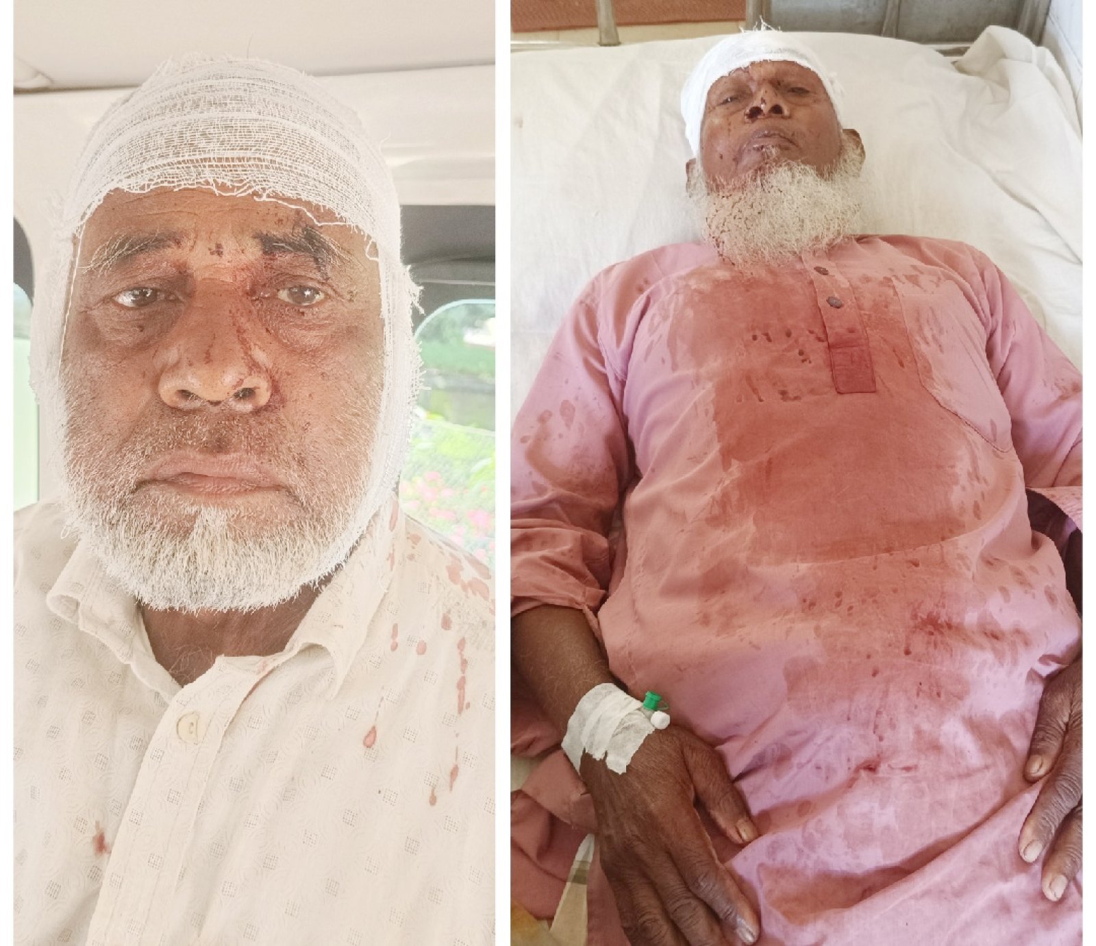 নিয়ামতপুরে জমি নিয়ে দু’পক্ষের সংঘর্ষে আহত-৫