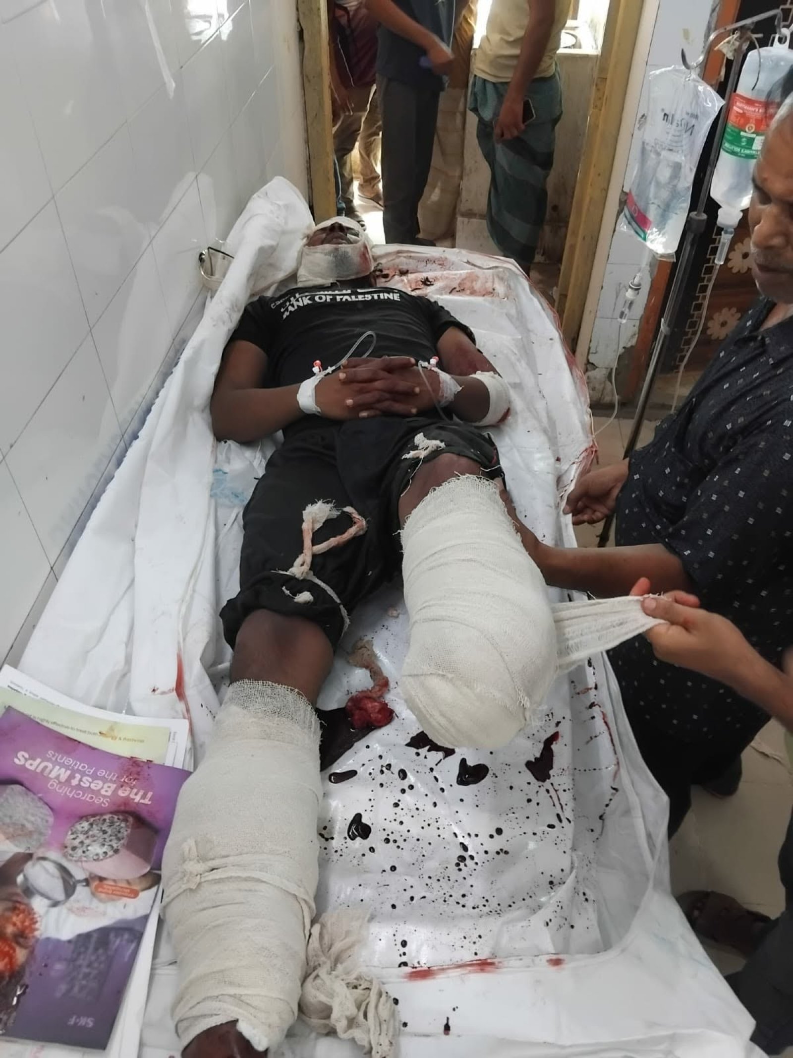 গাইবান্ধা ট্রেনের ধাক্কায় দুই পা বিচ্ছিন্ন ॥ পরে যুবকের মৃত্যু
