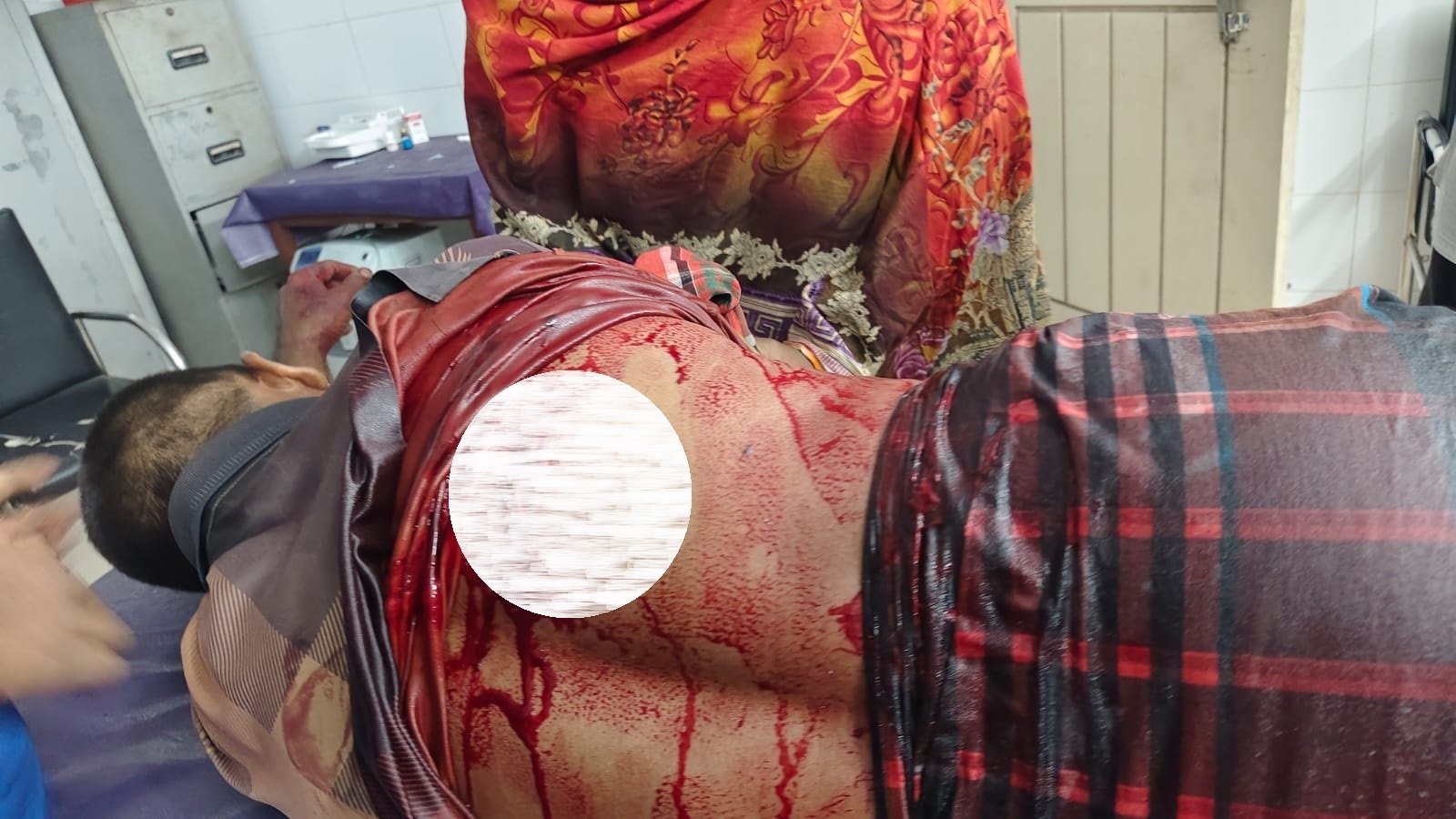 কানসাট-গোমস্তাপুর সড়কে ভ্যানচালকের ওপর ডাকাত দলের হামলা