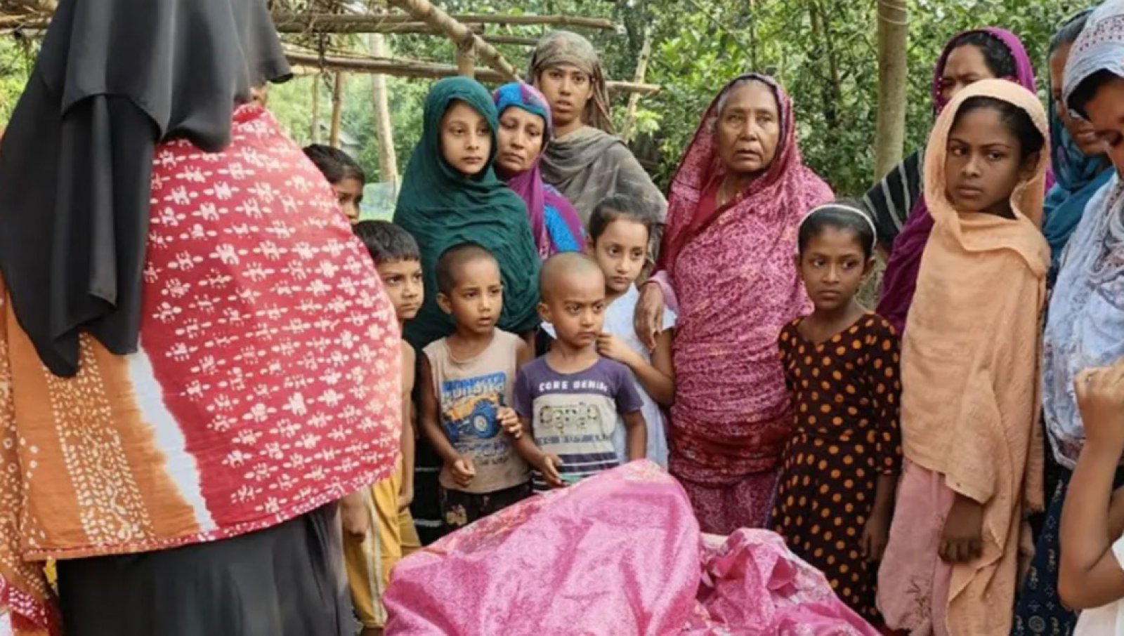 চুয়াডাঙ্গায় হামে প্রথম শিশুর মৃত্যু ॥ আরও ৫ শিশু হাসপাতালে ভর্তি