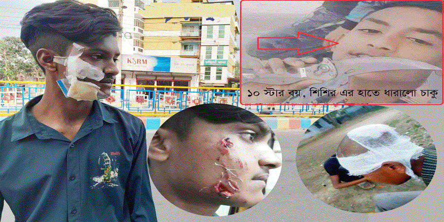 রাজশাহী নগরীতে গ্যাং স্টার গ্রুপের হামলায় ৪ যুবক আহত