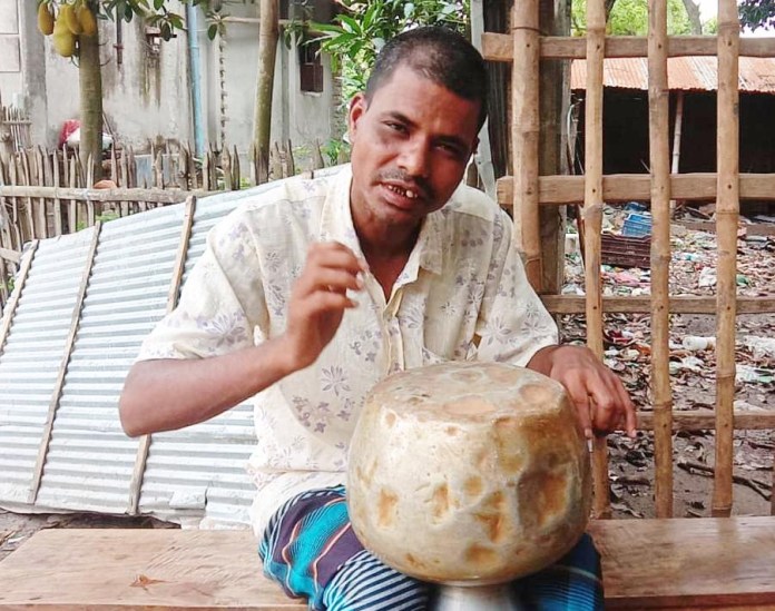 দৃষ্টি প্রতিবন্ধী মিজান কলস বাজিয়ে গান গেয়ে জীবিকা নির্বাহ করে